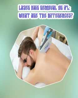 Ipl hair removal treatment